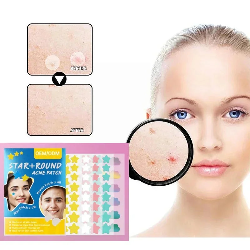 Aesthetic Star Pimple Patches